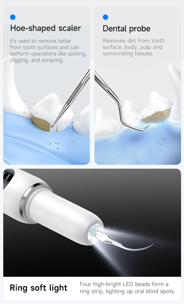 Ultrasonic Pet Dental Scaler — Vet-Style Plaque Removal at Home
